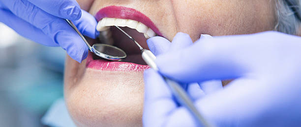 Best Emergency Wisdom Tooth Extraction in Way, NE