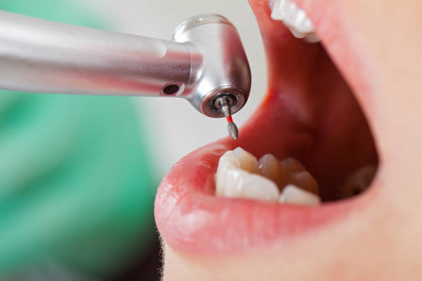 Best Urgent Dental Care for Toothaches in Way, NE